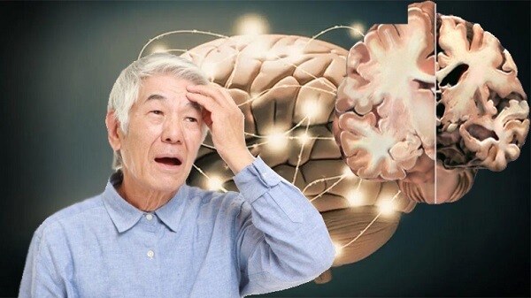 mất trí nhớ do Alzheimer